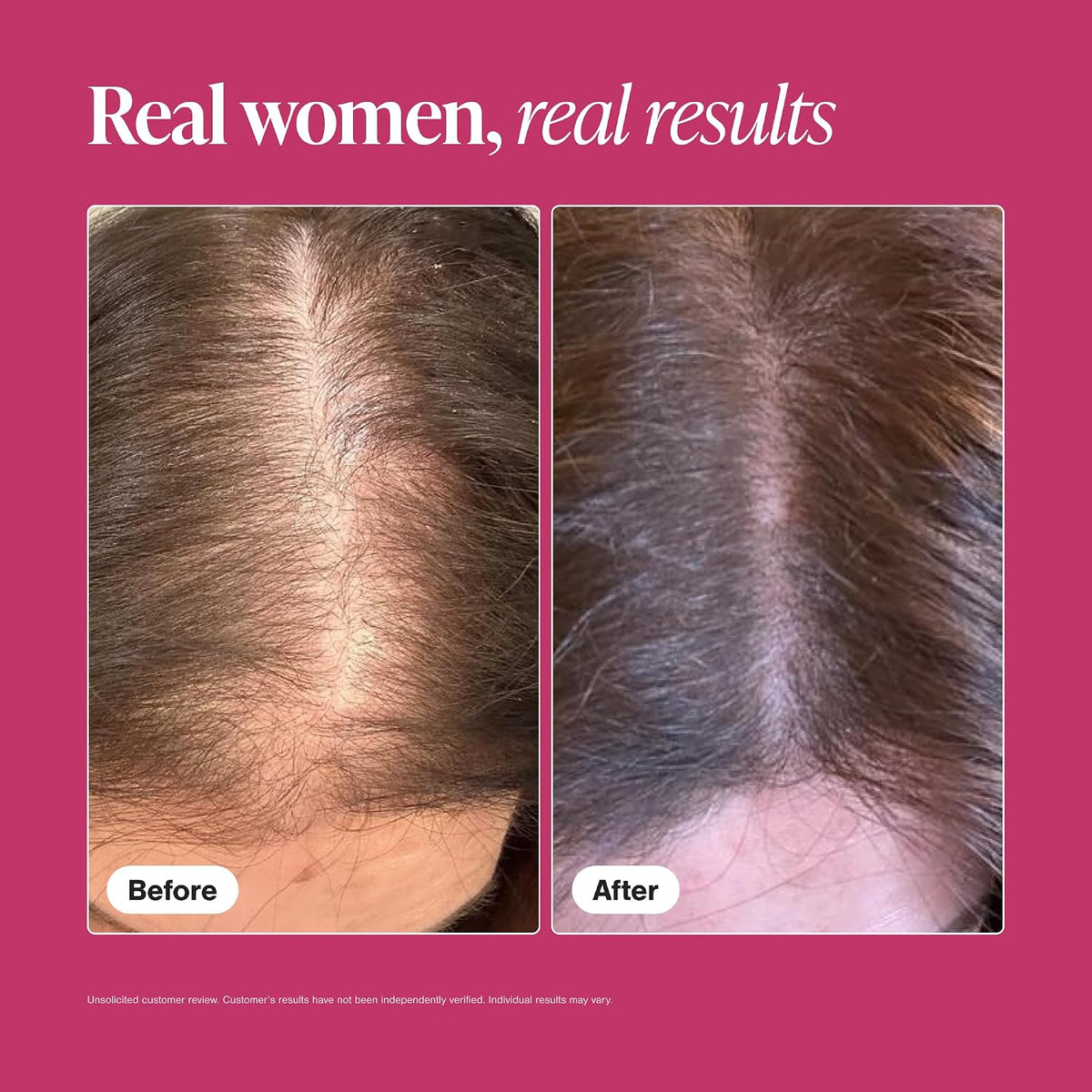 Viviscal Hair Growth Supplements for Women – 180 Tablets